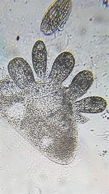  Burrowing Ciliate! A Tiny Master Of Microscopic Excavation And Feasting Frenzy