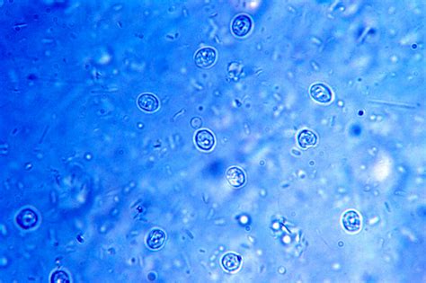  Cryptosporidium: Un parasite microscopique aux habitudes surprenantes!