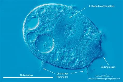  Didinium, un Prédateur Microscopic qui Chasse avec des Trichocystes Explosifs!