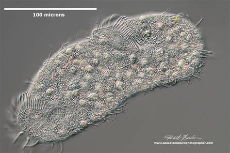  Rhinchophyllum! Un Cilié Enigmatique Qui Remue La Boue Et Se Déplace Avec Elegance